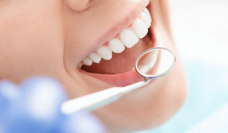 たんぽぽ歯科の審美歯科治療